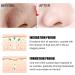 Blackhead Remover Pore Strips Blackhead Mask Blackhead Strips Blackhead Mask Blackhead Remover Mask Peel off Mask Facial Pore Cleanser Purifying Face Mask Nose Strips - Buy Online on GoSupps.com