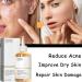 7% Glycolic Acid Toner Glycolic Acid Toner Suitable for All Skin Type Gylcolic Acid Glycolic Acid 7% Toner Skincare Hydrating Toner Brighten Rejuvenate Moisturize & Strengthen Your Skin - Buy Online on GoSupps.com