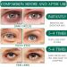 Collagen Eye Pads 60 PCs Hydrating Eye Masks for Dark Circles & Puffiness | Aloe Vera & Hyaluronic Acid Formula - Buy Online on GoSupps.com