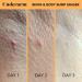 SweetSpot Labs Bikini & Body Bump Eraser - Razor Bump and Dark Spot Treatment - Niacinamide & Bentonite Clay - 0.5 oz (1 Pack) - Buy Online on GoSupps.com