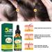 Ginger Hair Growth Serum Anti Hair Loss Essence Natural Herbal Essence Hair Growth Oil for Bald Thin Hair Fast Growth Hair Loss Treatment for Men and Women - Buy Online on GoSupps.com