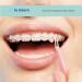 Non Latex 300pcs 1/4 (6.4mm) Medium Intraoral Elastic Bands - Made in US - Orthodontic Elastics Dental Rubber Bands - Buy Online on GoSupps.com