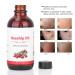 Rosehip Oil 118 ml - Natural Anti-Aging Moisturizing Massage & Spa Essential Oil for Aromatherapy - Buy Online on GoSupps.com
