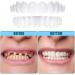 Mxrfactory Teeth Prosthesis Pebble Gel Snap-On Smile - Temporary Cosmetic Tooth Set for Men | 10 Pairs Removable Braces Cover & Repair - Buy Online on GoSupps.com