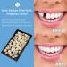 70PCS Temporary Tooth Crown Temporary Crowns for Teeth Tooth Repair Kit Dental Temporary Tooth Cap Crown Front Fake Teeth Tooth Crown False Tooth Replacement Temporary Crown for Tooth Repair - Buy Online on GoSupps.com
