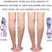 Buy Lin Performance 20-30 mmHg Compression Socks - Knee High Open Toe for Varicose Veins & Swollen Legs (Beige Medium) - Unisex Medical Support Stockings - Buy Online on GoSupps.com