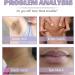 Dark Spot Remover Cream Anti Dark Spot Pigment Spot Remover Dark Spot Remover for Inner Thighs Skin Brightening Cream Face Cream for Correcting Dark Spots - Buy Online on GoSupps.com