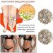 JIAWEIIY Dorina Ear Acupressure Magnetherapy Earrings 2/3Pairs Dorina Earrings Weight Loss Magnetic Earrings Ear Acupressure Earring (D) - Buy Online on GoSupps.com