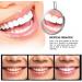 Smilekit Purple Toothpaste Series - Color Corrector & Teeth Whitening (2PCs) | International Shipping Available - Buy Online on GoSupps.com