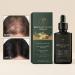 Solution paississante pour cheveux formule non grasse pour cuir chevelu solution amincissante avec m ches de cheveux volume de soutien de la croissance des cheveux soin quotidien du cuir chevelu - Buy Online on GoSupps.com