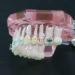 HDGRNCC Dental Orthodontic Brackets Model - Metal Ceramic Self-Ceramic Bracket for Training | International Shipping - Buy Online on GoSupps.com