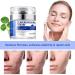 Scar Removal Cream - Natural Scar Repair for Acne Stretch Marks & More | Effective for Old & New Scars on Face & Body - Buy Online on GoSupps.com