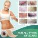 Medical Grade Silicone Scar Sheets - Reusable Treatment for Surgical Scars, Keloids, and Acne - 1.6 x 60 Roll - Buy Online on GoSupps.com