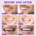 SP-7 Ultra Whitening Toothpaste - Probiotics for Fresh Breath & Stain Removal | Best Teeth Whitening Solution (Purple - Buy Online on GoSupps.com