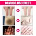 Purer Intimate Whitening Cream for Underarms, Knees, and Intimate Areas - Buy Online on GoSupps.com