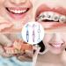 Prosthesis Hooks & Toothbrush Set - 2 Pieces for All Dentures Cleaning | International Shipping Available - Buy Online on GoSupps.com