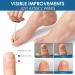Extra Strength Toenail & Fingernail Repair Liquid - Restore Healthy Nails - 1 Count - Buy Online on GoSupps.com