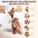 LightenUp Skin Brightening Lotion 13.5 Fl oz - Hyperpigmentation Body Cream with Jamaican Castor Oil and Shea Butter - Buy Online on GoSupps.com