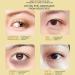Masque contour des yeux l'avocat (60 pi ces) masque hydratant au collag ne id al pour am liorer la peau s che du contour des yeux lisser et rajeunir la peau. 1PCS - Buy Online on GoSupps.com