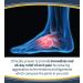 Dr. Scholl's ARCH Pain Relief Orthotics Insoles for Women (Size 6-10) - 1 Pair Blue Shoe Inserts - Buy Online on GoSupps.com
