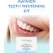 Awaken Professional Teeth Whitening Kit with LED Light Visibly Whitens Teeth After 1 Use Enamel Safe Includes Dual-Arch Tray & 2 Gel Syringes Up to 8 Shades Whiter in 7 Days - Buy Online on GoSupps.com