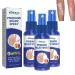 South Moon Psoriasis Repair Spray Kolmax Psoriasis Relief Spray Professional Psoriasis Treatment Spray Treatment for Plaque Psoriasis Psoriasis Treatment for Skin (3PCS)