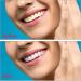 Press Tooth Veneers - 2 Pairs of Cosmetic False Teeth for a Perfect Smile | Repair Your Teeth & Enhance Your Confidence - Buy Online on GoSupps.com