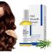  Yuemxixi Hair Regrowth Natural Scalp Care Roller 30ml Natural Hair Thickening and Growth | For Frizz Follicles Slimming Health Men Seniors Home Travel - Buy Online on GoSupps.com