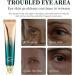 Retinol Eye Cream Anti Aging Under Repair Eyecream for Dark Circles and Puffy Eyes Moisturising Anti-Wrinkle Eye Creams Under Eye Enhancer Brightener Eyes Bags Remover - Buy Online on GoSupps.com