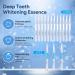 Teeth Whitening Kit Teeth Whitening Kit with LED Light - Teeth Whitening Kits Teeth Whitener Including Mouth Tray 12 Teeth Whitening Gels 3 Desensitizing Gels and Storage Case - Buy Online on GoSupps.com