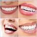 377-Piece Tooth Gem Kit | DIY Fashionable Tooth Jewelry Set with Artificial Crystal Decor for Reflective Teeth | Stylish Style - Buy Online on GoSupps.com