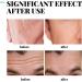 Men's Skin Tightening Face Cream - Anti Aging Moisturizer to Reduce Fine Lines and Wrinkles Face Cream Moisturiser for Men Anti Wrinkle Skincare for a Smoother Youthful Appearance - Buy Online on GoSupps.com