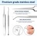 152-Piece Ingrown Toenail Tool Set & Correction Patch for Ingrown Toenails - International Shipping Available - Buy Online on GoSupps.com