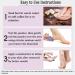 6 Packs Foot Pumice Stone Double Sided Foot Scrub for Feet Hard Skin Callus Remover and Scrubber Exfoliating Dead Skin - Buy Online on GoSupps.com