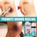 KOAHDE Gel Liquid Bandage 10ML - Breathable & Waterproof Wound Care for Minor Cuts - Buy Online on GoSupps.com