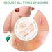 Mebak C-Section Silicone Scar Sheets - Medical Grade Reusable Treatment Patches for Keloid Surgical Scars Removal - Transparent, 8 Inches Long - Buy Online on GoSupps.com