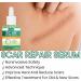Imtrub Scar Guards Moisturizing Scar Repair Oil for Skin Repair 30 ml Scar Repair Smoothing to Reduce Scar Scars Pregnancy - Buy Online on GoSupps.com