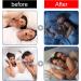 Fekux Stop Snoring Sleep Strips - 60 Count Mouth Tape Strips for Improved Nose Breathing and Reduced Snoring at Night - Buy Online on GoSupps.com