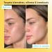 Super Facialist Clear Out Clarifying Mask - Acne Treatment & Blackhead Remover Face Mask with 1% Niacinamide Tea Tree Oil & Prebiotics Vegan Friendly 125ml - Buy Online on GoSupps.com