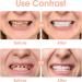 Plotage Artificial Teeth - White Cosmetic Prosthesis Stickers | Temporary Teeth Filling Set for Men & Women - Buy Online on GoSupps.com