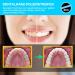 Buy Aisely Tooth Sandpaper - 2 Dental Polishing Strips 4mm Wide 6m Roll - Interdental Grinding Tools for Polishing Teeth - Blue - Buy Online on GoSupps.com