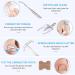 Ingrown Toenail Treatment Kit with 12 Braces, 50 Nail Patches, and Tools for Removal and Correction - Buy Online on GoSupps.com
