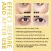 Rollerball Castor Oil & Frankincense Eye Roller | Reduce Dark Circles & Bags Under Eyes - International Shipping - Buy Online on GoSupps.com