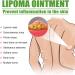 Delipidation Cream for Lipoma Removal and Anti-Swelling - Cellulite Ointment for Lipoma Lumps - Buy Online on GoSupps.com