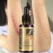 Hotiary Scar Removal Serum - Lavender Repair Essence 30g (1 Pack) - Skin Repair for Cuts, Stretch Marks, Burns & Postoperative Scars - Buy Online on GoSupps.com