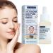 Young lactobionic acid hydrating lactobionic acid 30ml lactobionic acid active skin always young repairs fine pores for thirsty skin