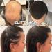 Elite Hair Fibers | All Natural Solution for Instantly Increasing Hair Density | For Men & Women | 27.5g (Medium Brown) - Buy Online on GoSupps.com