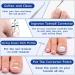 Professional Ingrown Toenail Treatment Kit - Includes Toenail Corrector, Tweezer, Strips, Braces, and Patches - Buy Online on GoSupps.com