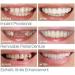 BGZ 5 Couples Perfect Smile Teeth Veneers - Instant Snap-On Dentures for Flawless Smile | Temporary Braces for Imperfect Teeth (5 Upper & 5 Lower) - Buy Online on GoSupps.com