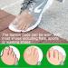 Buy 10 Pieces Bunion Corrector & Silicone Toe Separators - Big Toe Spacer for Overlapping Toes | International Shipping Available - Buy Online on GoSupps.com